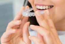 invisalign benefits guide london