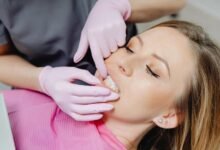 philadelphia teeth whitening guide