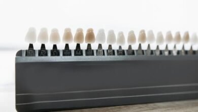 veneers guide rockville md